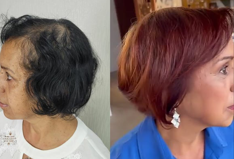Clientes do Natucap compartilham experiências de recuperação capilar